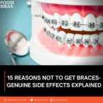 Reasons Not To Get Braces