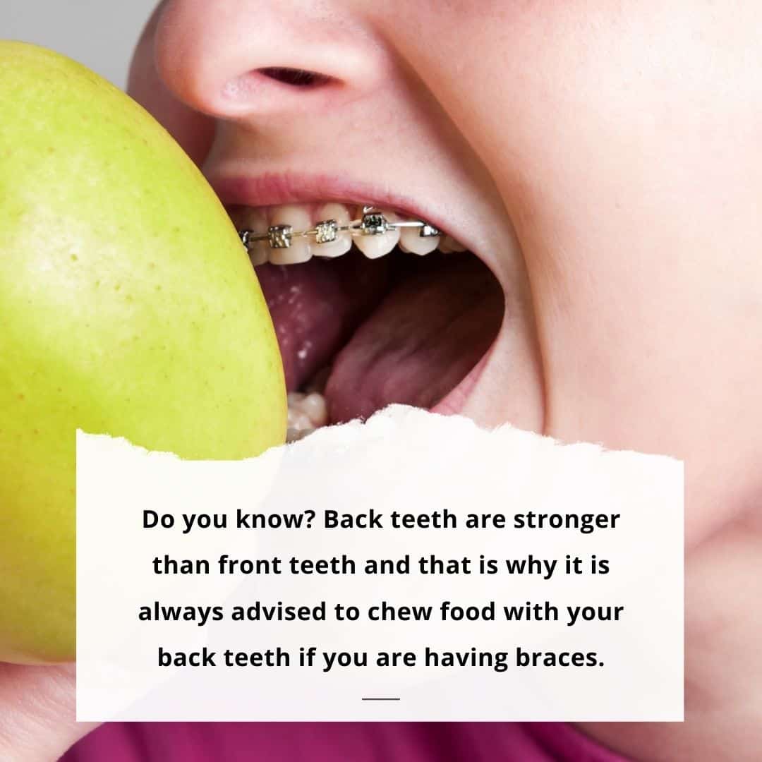 eat food with your back teeth while having braces