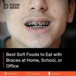 Best Soft Foods to Eat with Braces at Home, School, or Office