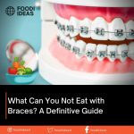 What Can You Not Eat with Braces A Definitive Guide
