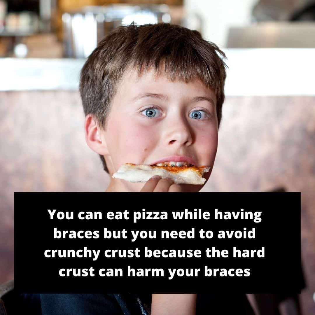you can eat pizza while having braces but avoid the crust