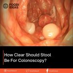 How Clear Should Stool Be For Colonoscopy