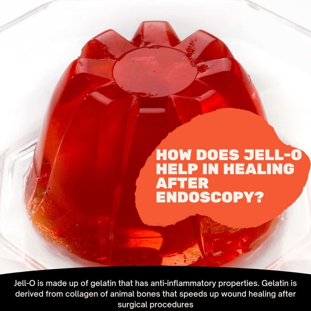 What to Eat After Endoscopy? A Complete Diet Plan in 2023