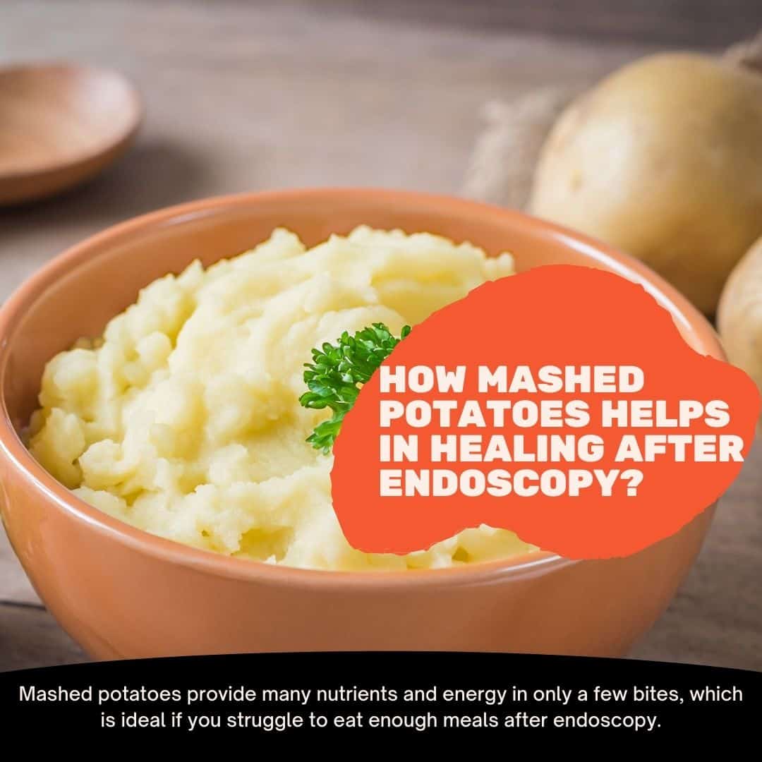 what-to-eat-after-endoscopy-a-complete-diet-plan-in-2023