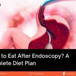what to eat after endoscopy - a complete diet plan